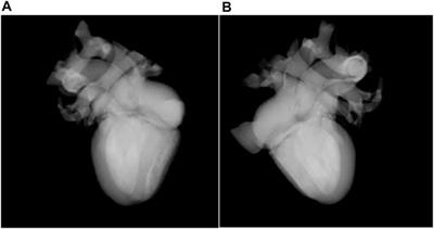 Cardiac biophysical detailed synergetic modality rendering and visible correlation